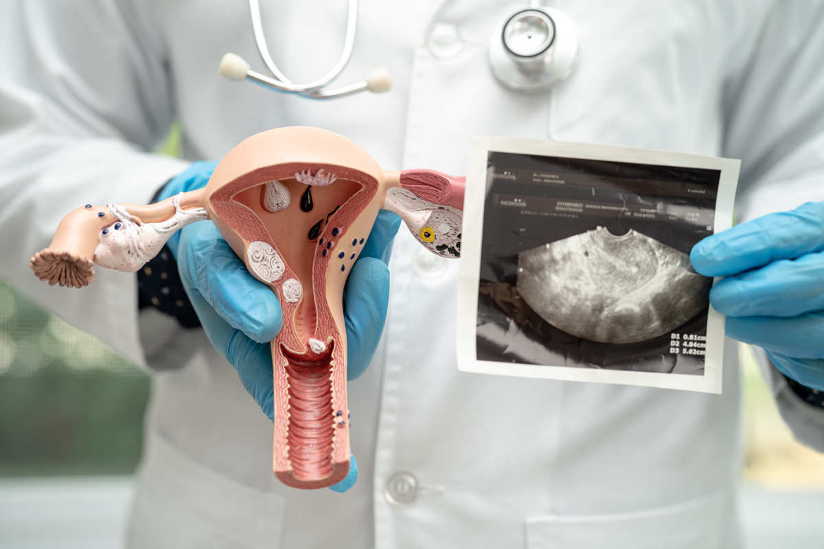 uterus-and-ovary-doctor-holding-anatomy-model-and-2025-02-24-20-32-46-utc